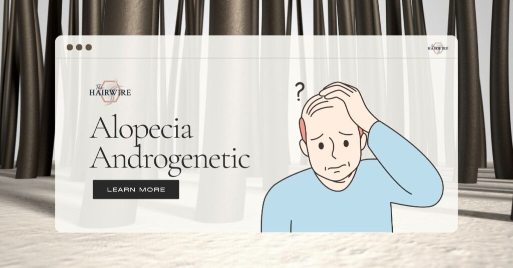Alopecia Androgenetic